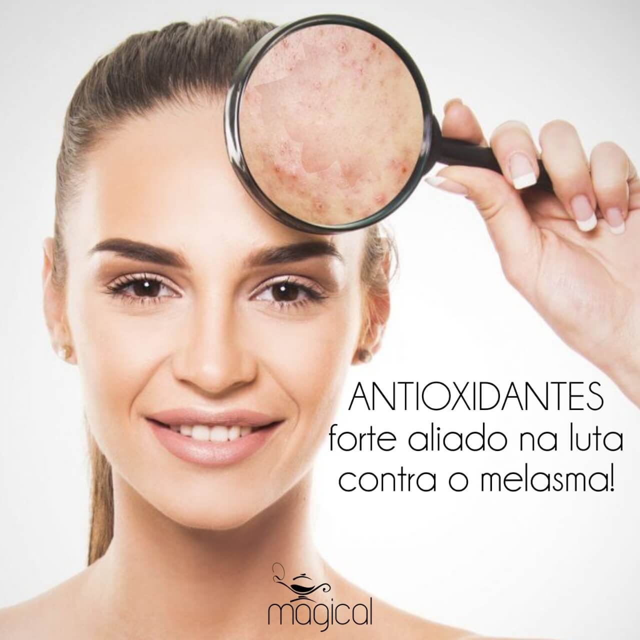 como tratar o melasma