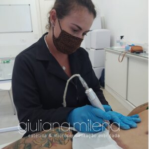 Profissional Giuliana Milena realizando o procedimento de Micropigmentação de Cicatriz